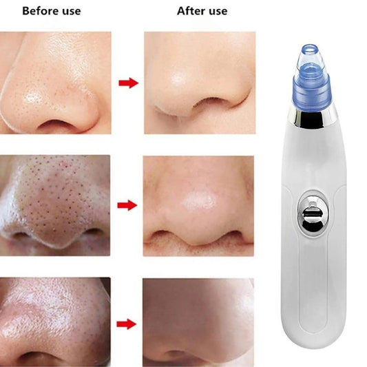 Derma Suction Facial Cleanser